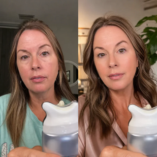 WORKS LIKE A TOPICAL NECK LIFT